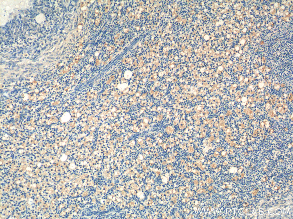 19243-1-AP;human ovary tissue