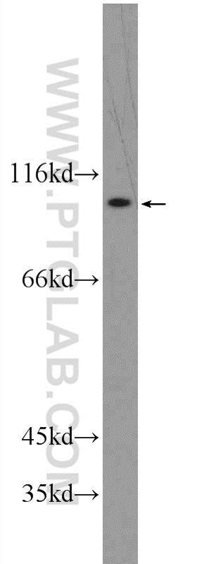 13231-1-AP;HEK-293 cells