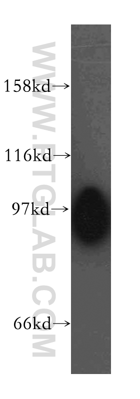 13619-1-AP;mouse skeletal muscle tissue