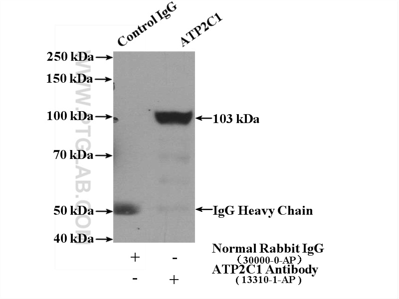 13310-1-AP;mouse kidney tissue