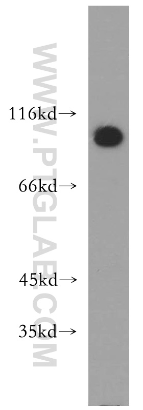 13310-1-AP;HeLa cells