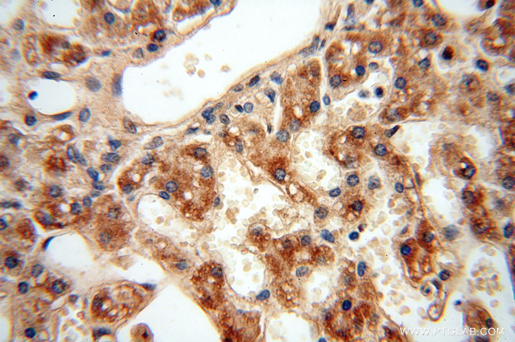 15999-1-AP;human liver