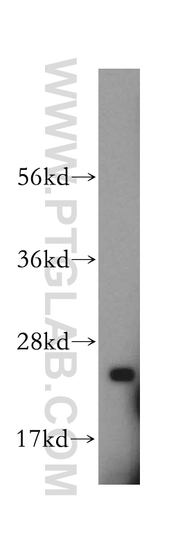 15999-1-AP;mouse liver tissue