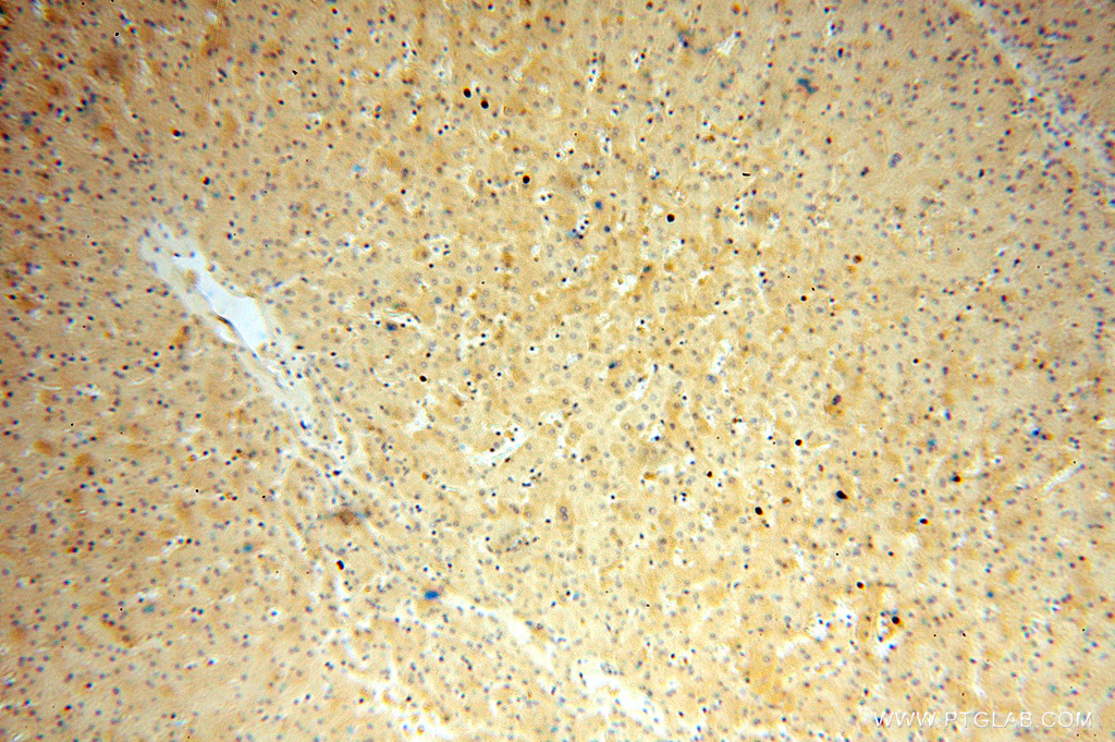 16483-1-AP;human liver