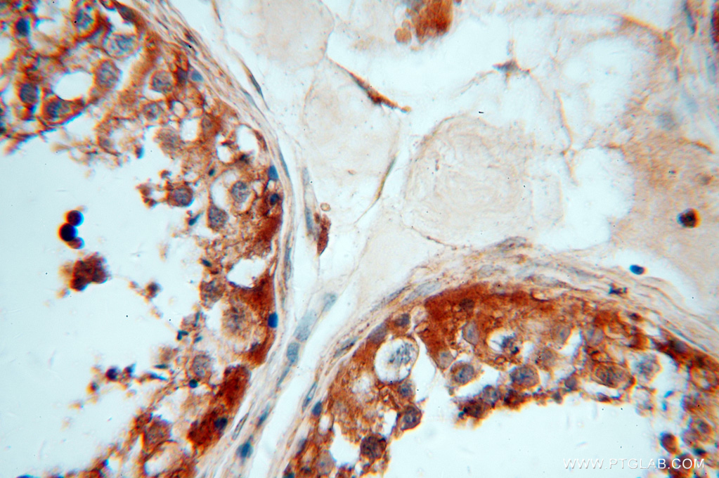 15280-1-AP;H-testis