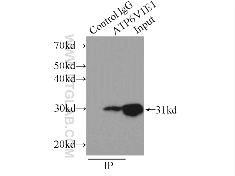 15280-1-AP;mouse brain tissue