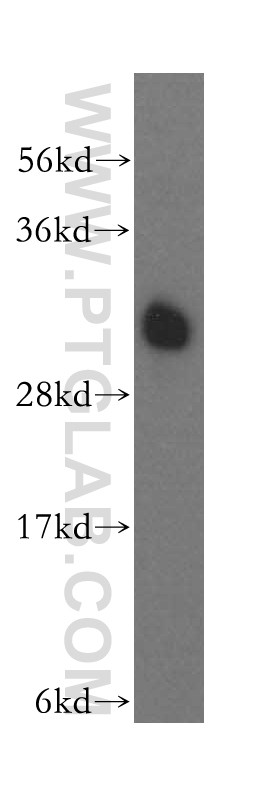 15280-1-AP;human brain tissue