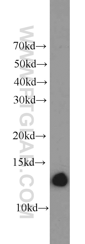 17725-1-AP;MCF7 cells