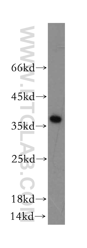 18016-1-AP;human heart tissue