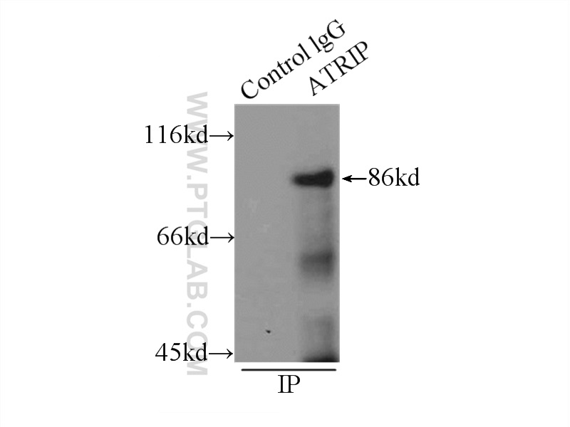 11327-1-AP;MCF-7 cells