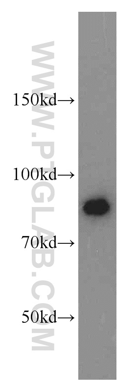 11327-1-AP;MCF7 cells