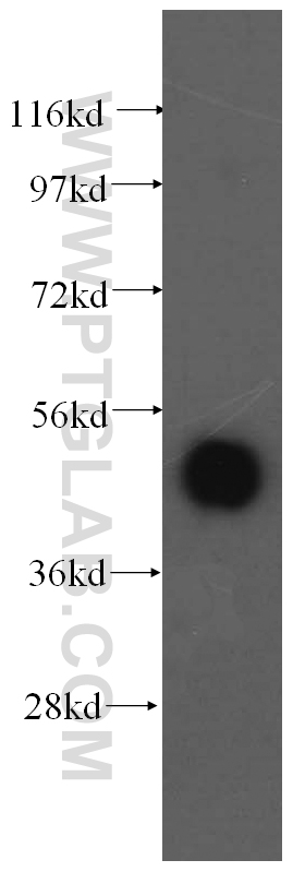 15693-1-AP;human brain tissue