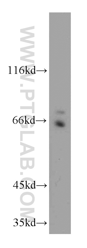 18162-1-AP;HeLa cell