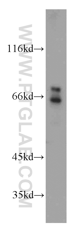 18162-1-AP;HEK-293 cells