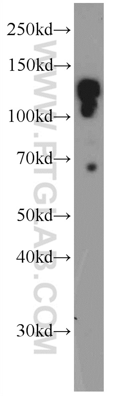 25735-1-AP;mouse testis tissue