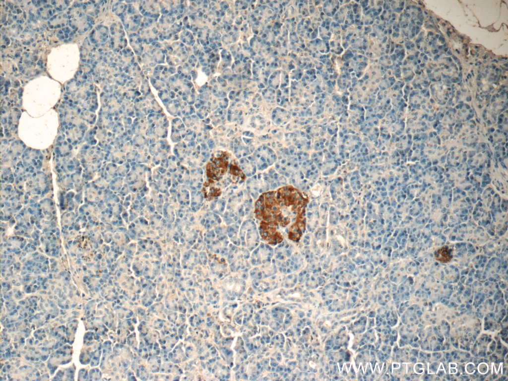 22305-1-AP;human pancreas tissue