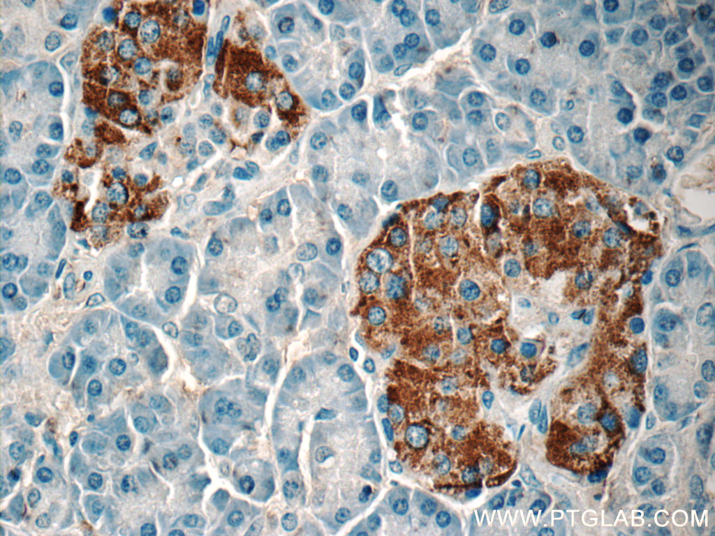 22305-1-AP;human pancreas tissue