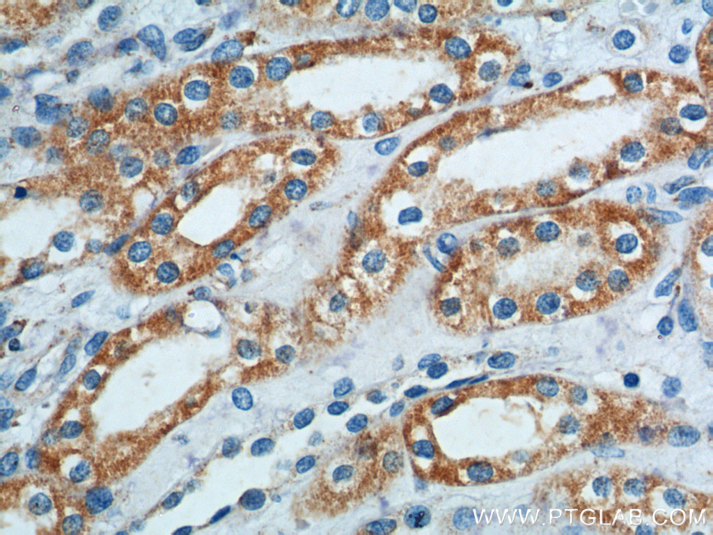 15200-1-AP;human kidney tissue