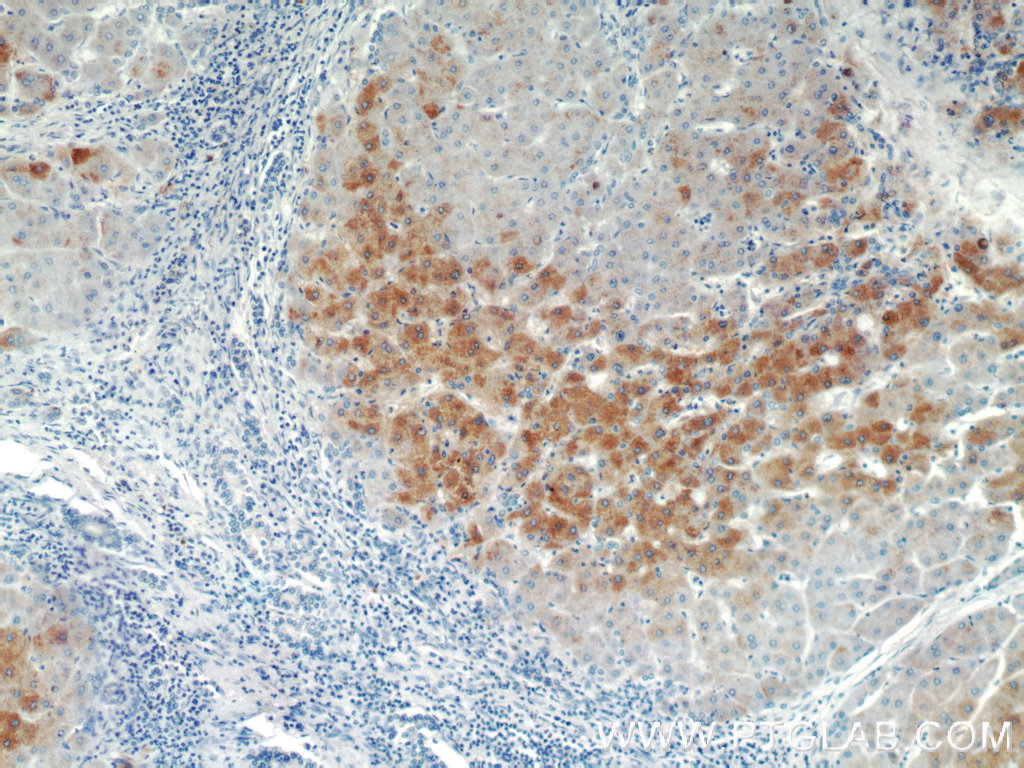 15990-1-AP;human hepatocirrhosis tissue