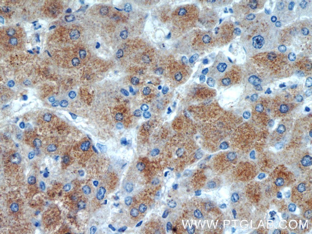 15990-1-AP;human hepatocirrhosis tissue