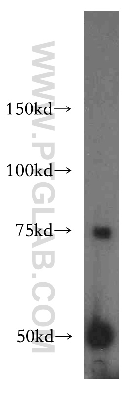 15990-1-AP;human liver tissue