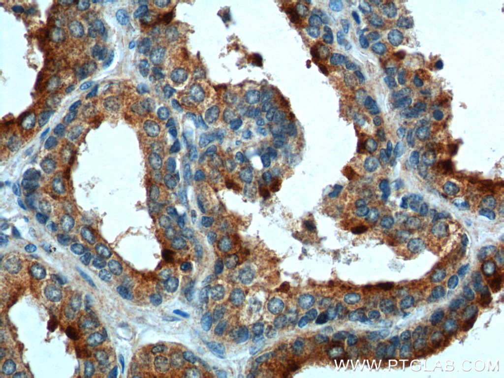 10435-1-AP;human prostate hyperplasia tissue