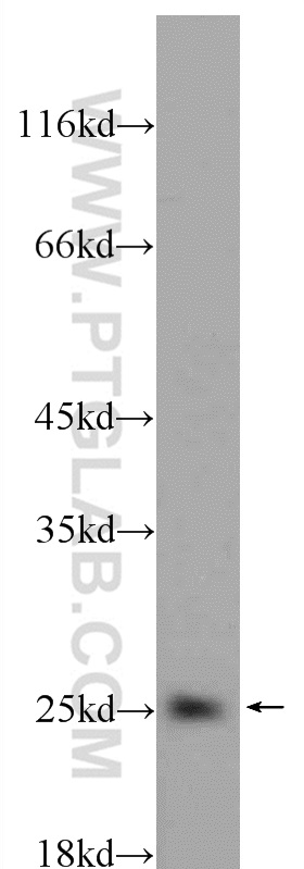 10435-1-AP;Tunicamycin treated HeLa cells