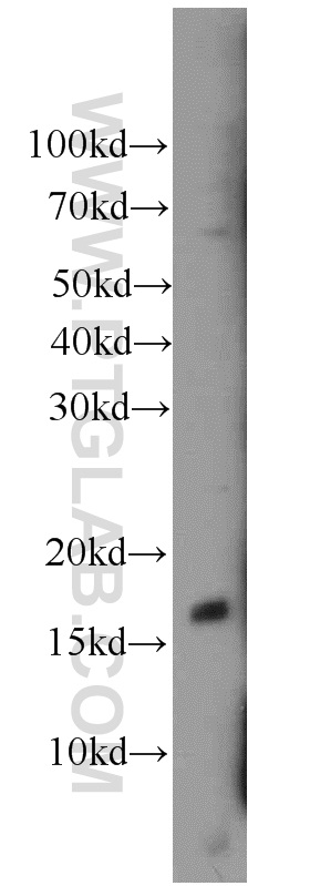 10435-1-AP;mouse heart tissue