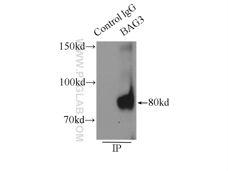 10599-1-AP;K-562 cells