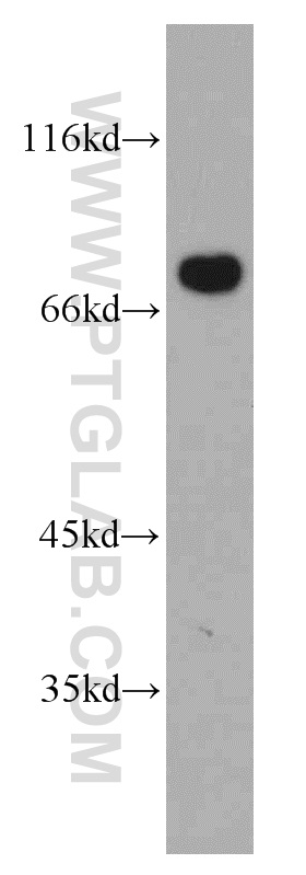 10599-1-AP;HeLa cells