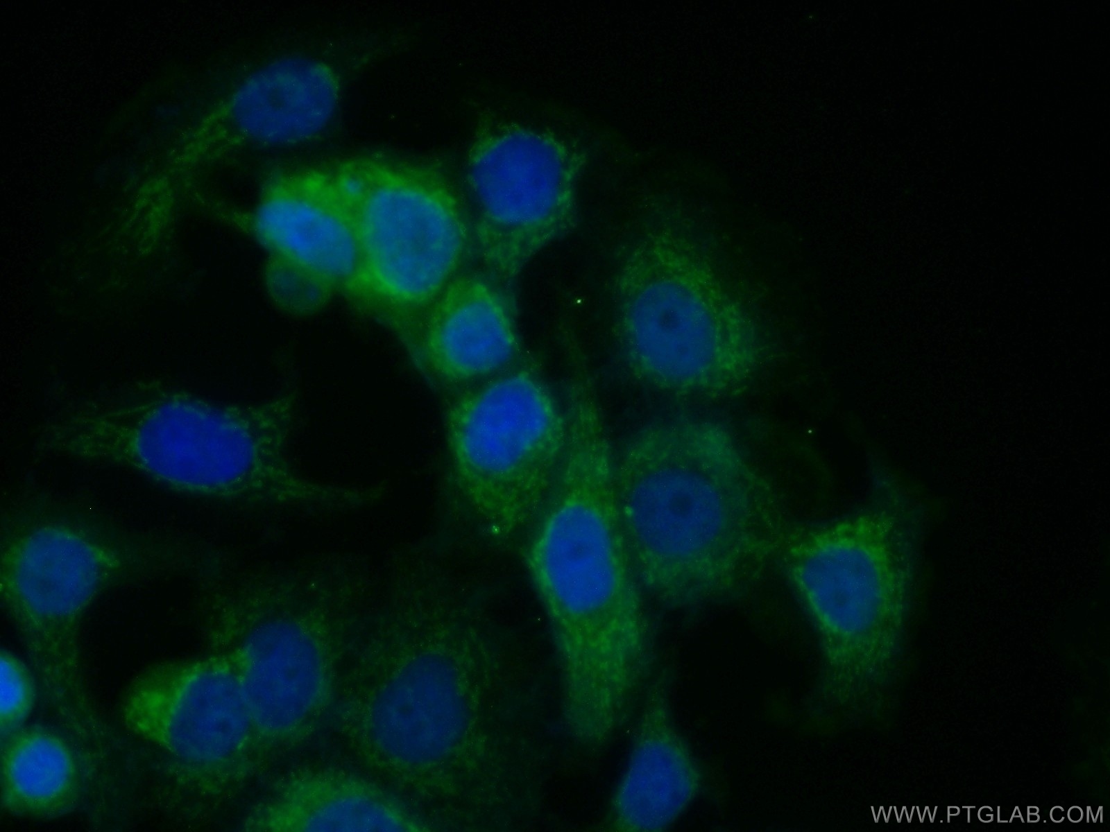 13913-1-AP;MCF-7 cells