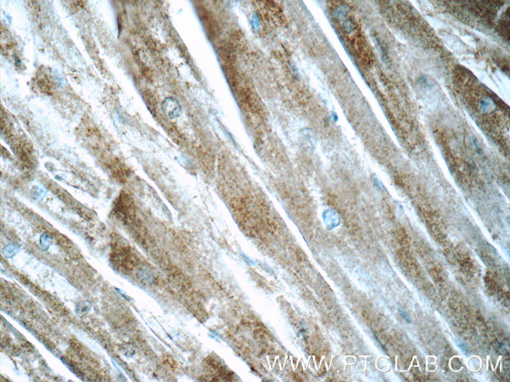 19680-1-AP;human heart tissue