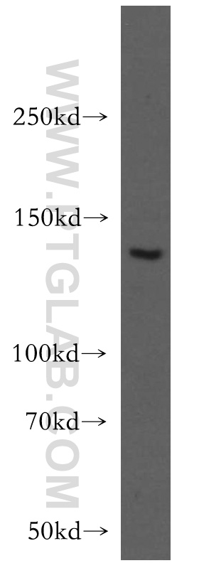 19789-1-AP;HEK-293 cell