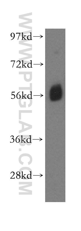 16393-1-AP;human kidney tissue