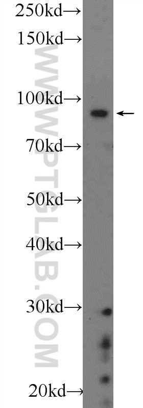 22964-1-AP;SH-SY5Y cells