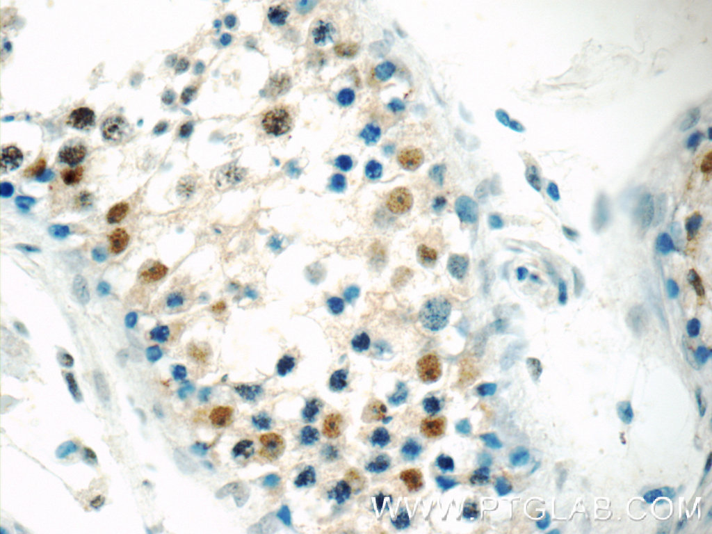 23976-1-AP;human testis tissue