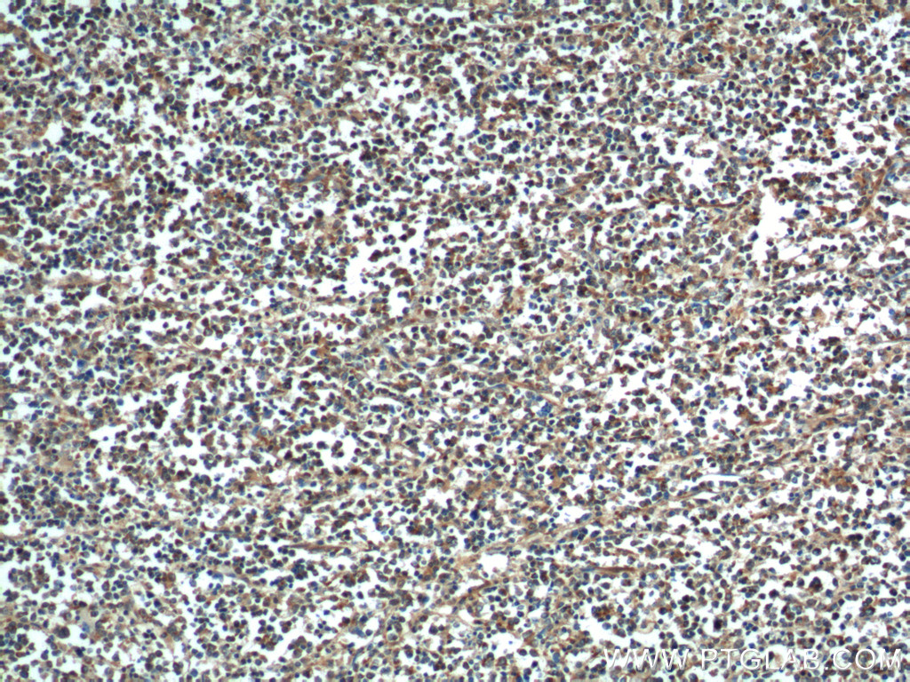 50599-2-Ig;human lymphoma tissue