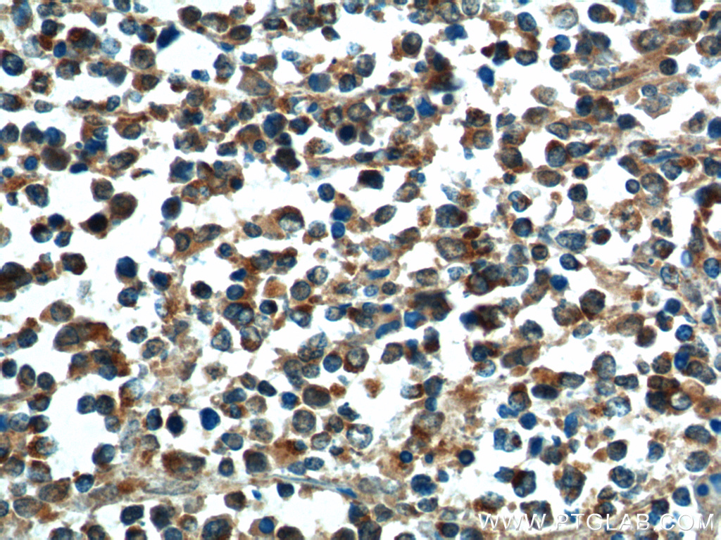 50599-2-Ig;human lymphoma tissue