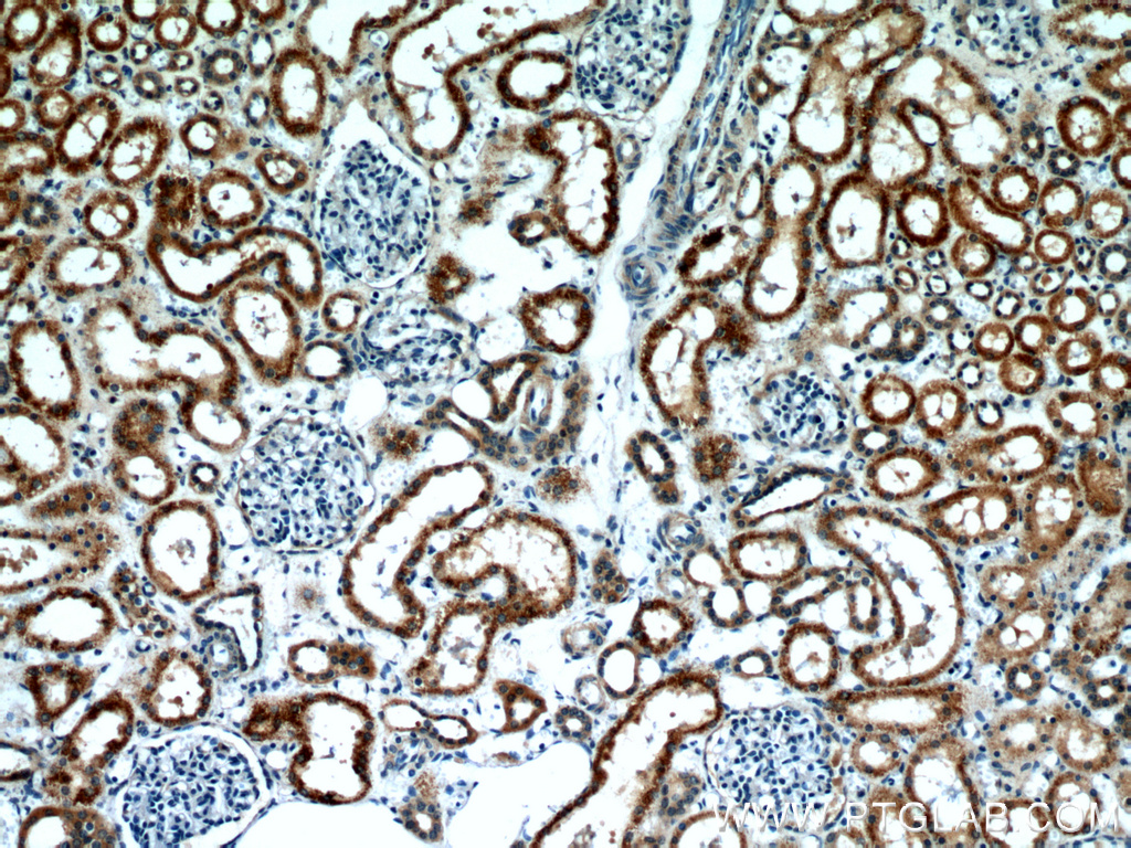 12766-1-AP;human kidney tissue