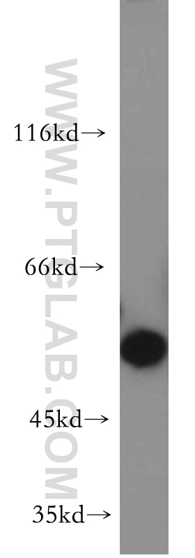 12766-1-AP;HEK-293 cells