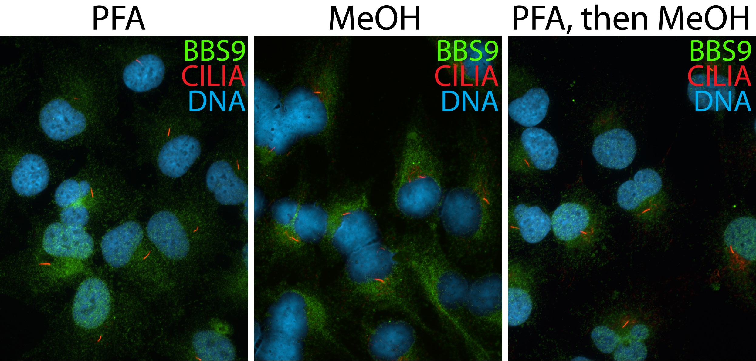 14460-1-AP;hTERT-RPE1 cells