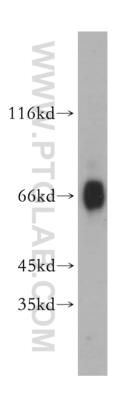 14460-1-AP;mouse testis tissue