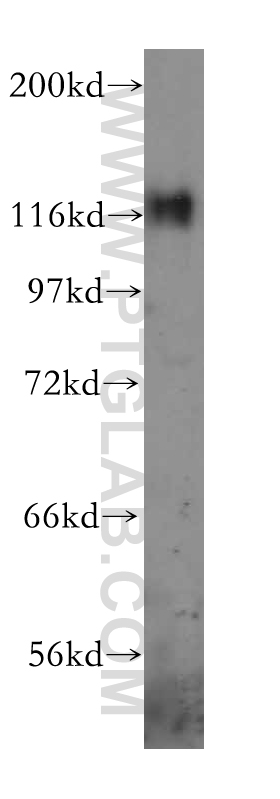 16815-1-AP;A431 cells