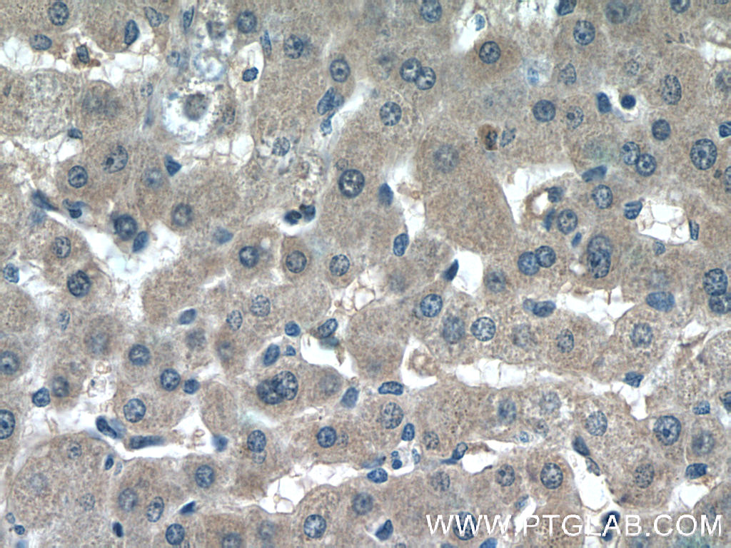 23854-1-AP;human liver tissue