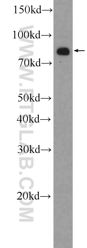 23854-1-AP;HeLa cells