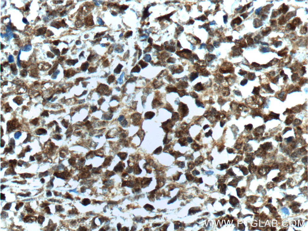 BCL6 Antibody 21187-1-AP | Proteintech