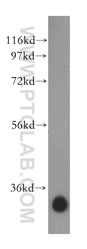 15417-1-AP;human liver tissue