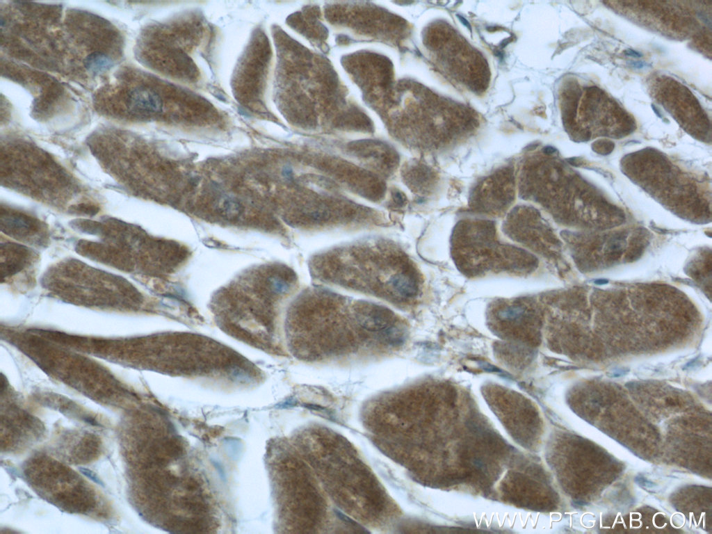 24711-1-AP;human heart tissue