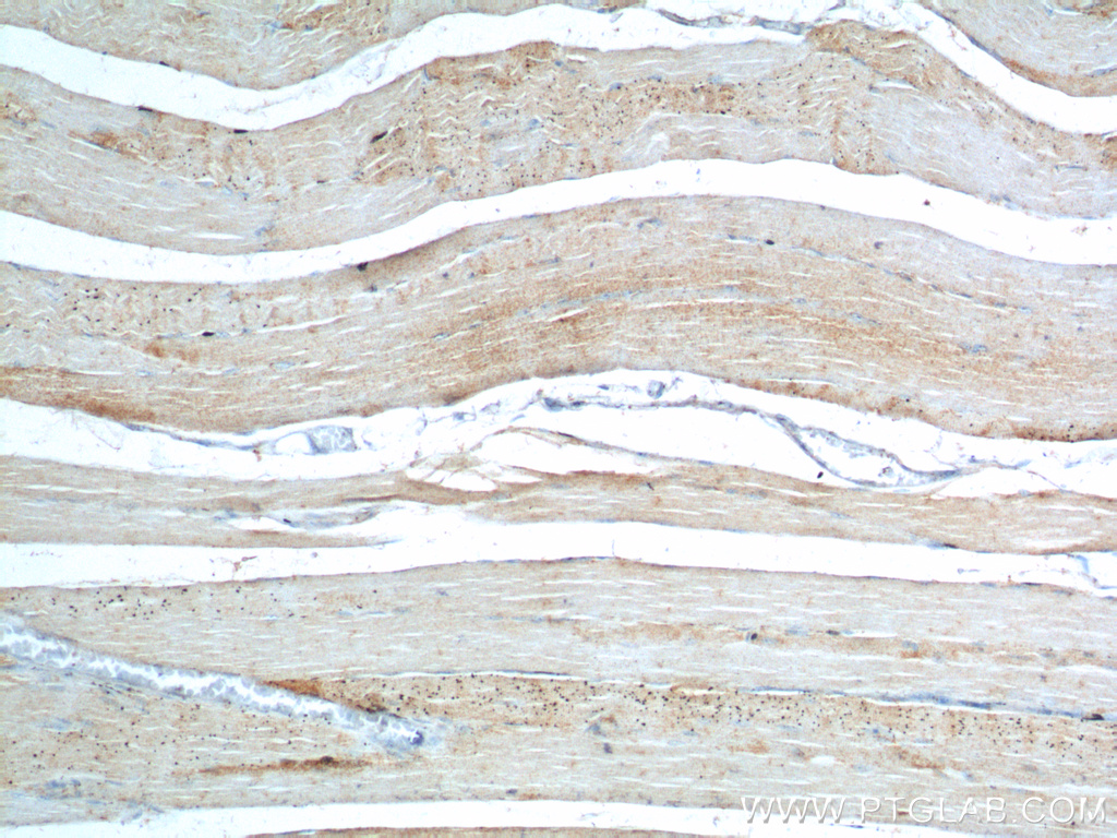 20443-1-AP;human skeletal muscle tissue