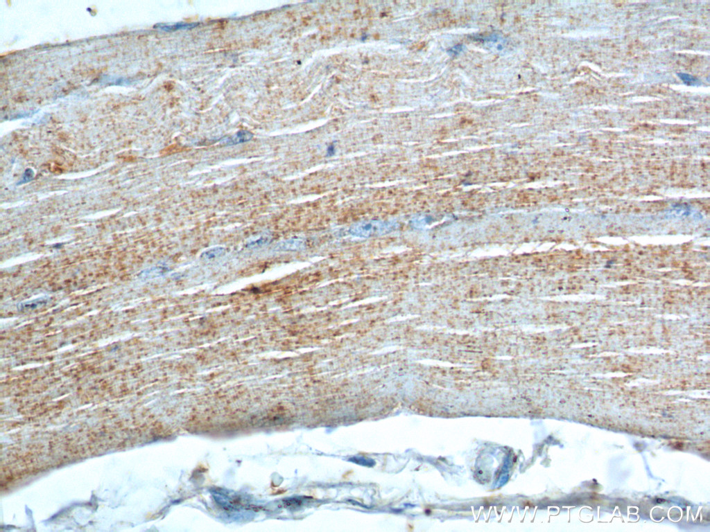 20443-1-AP;human skeletal muscle tissue